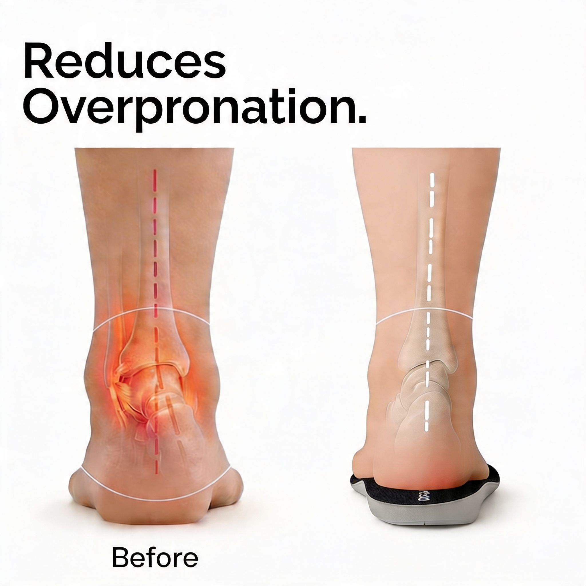 Dr Foot's Work Insoles