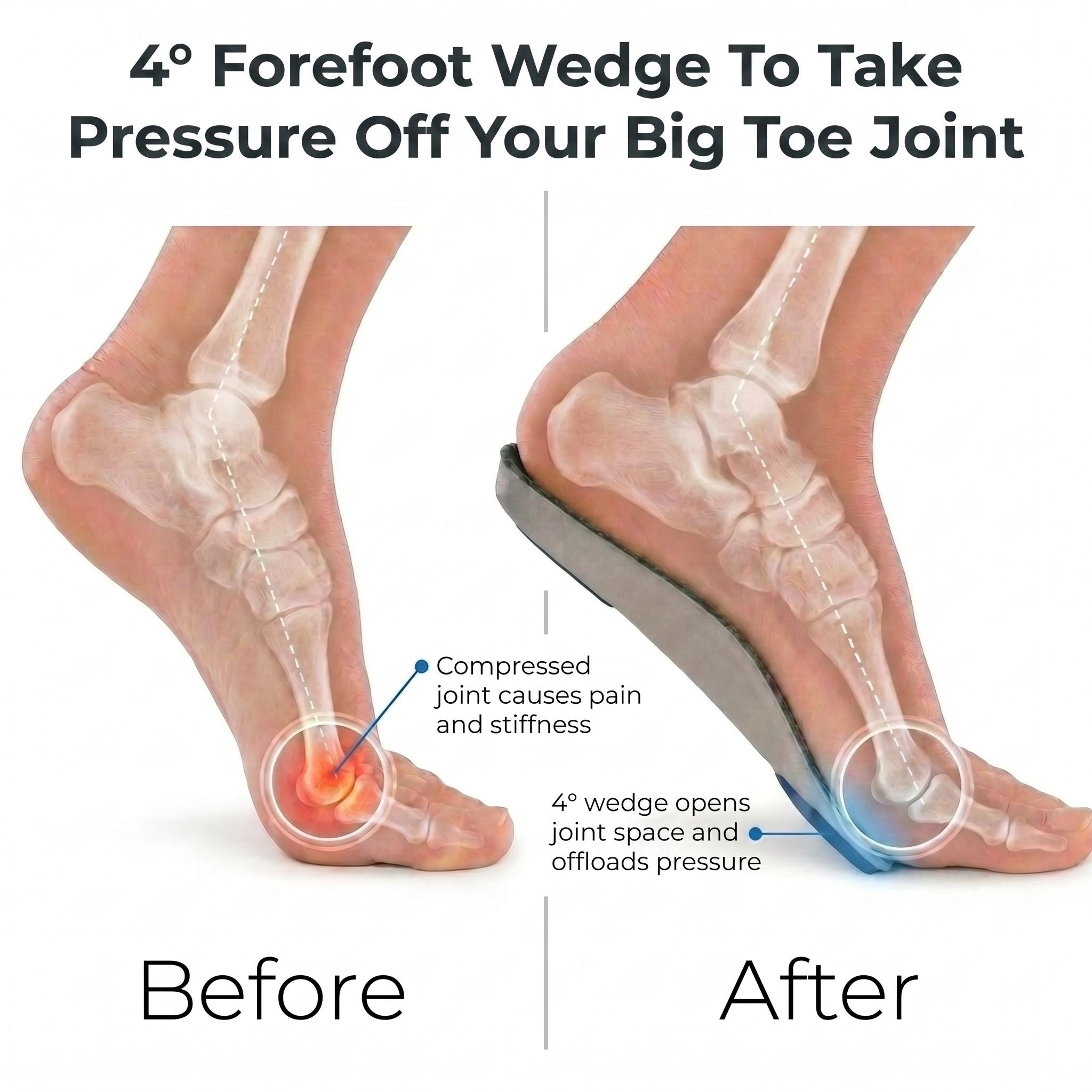 Dr Foot Pro Hallux Rigidus Insoles (3/4 length) Pair