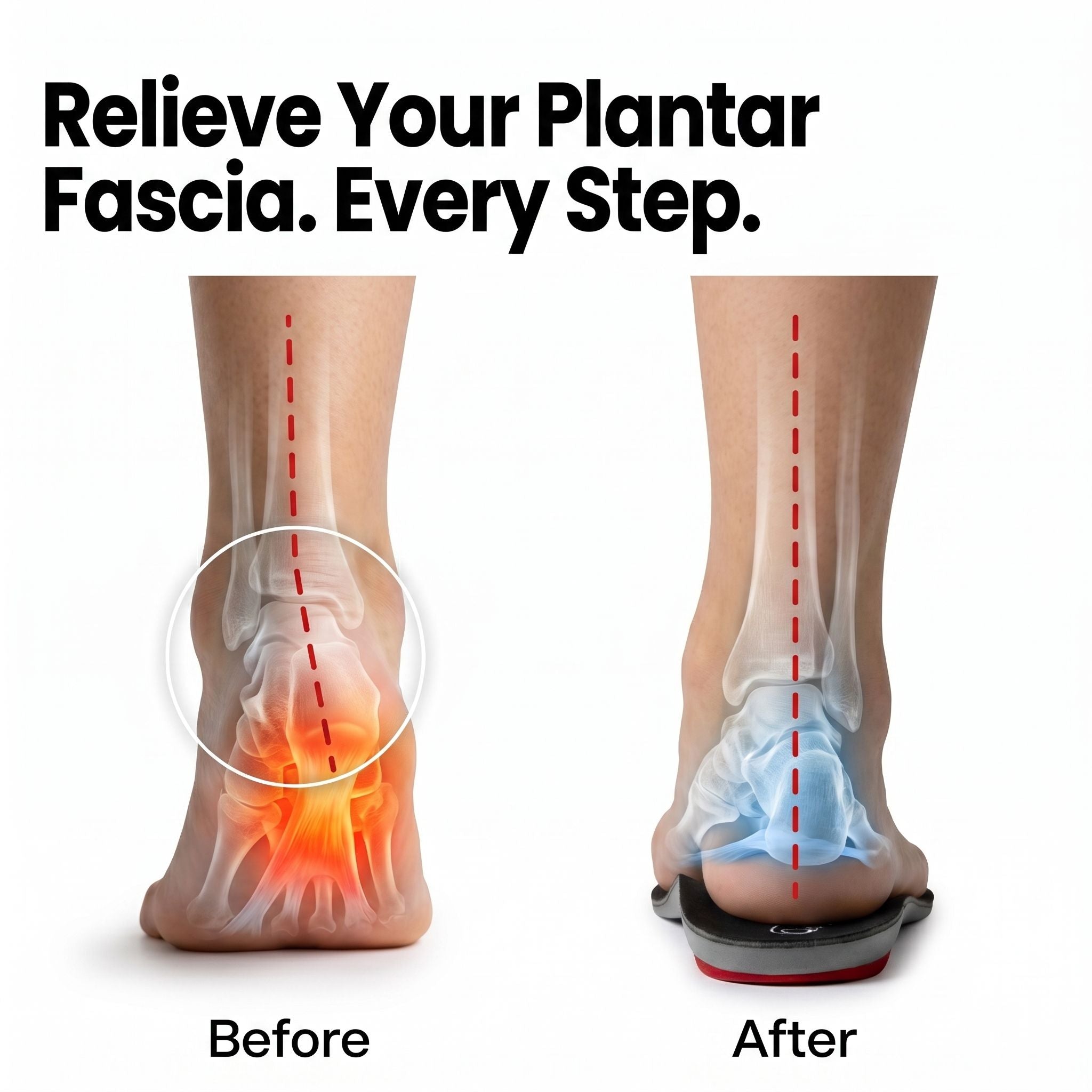 Dr Foot Plantar Fasciitis (Bespoke Series)