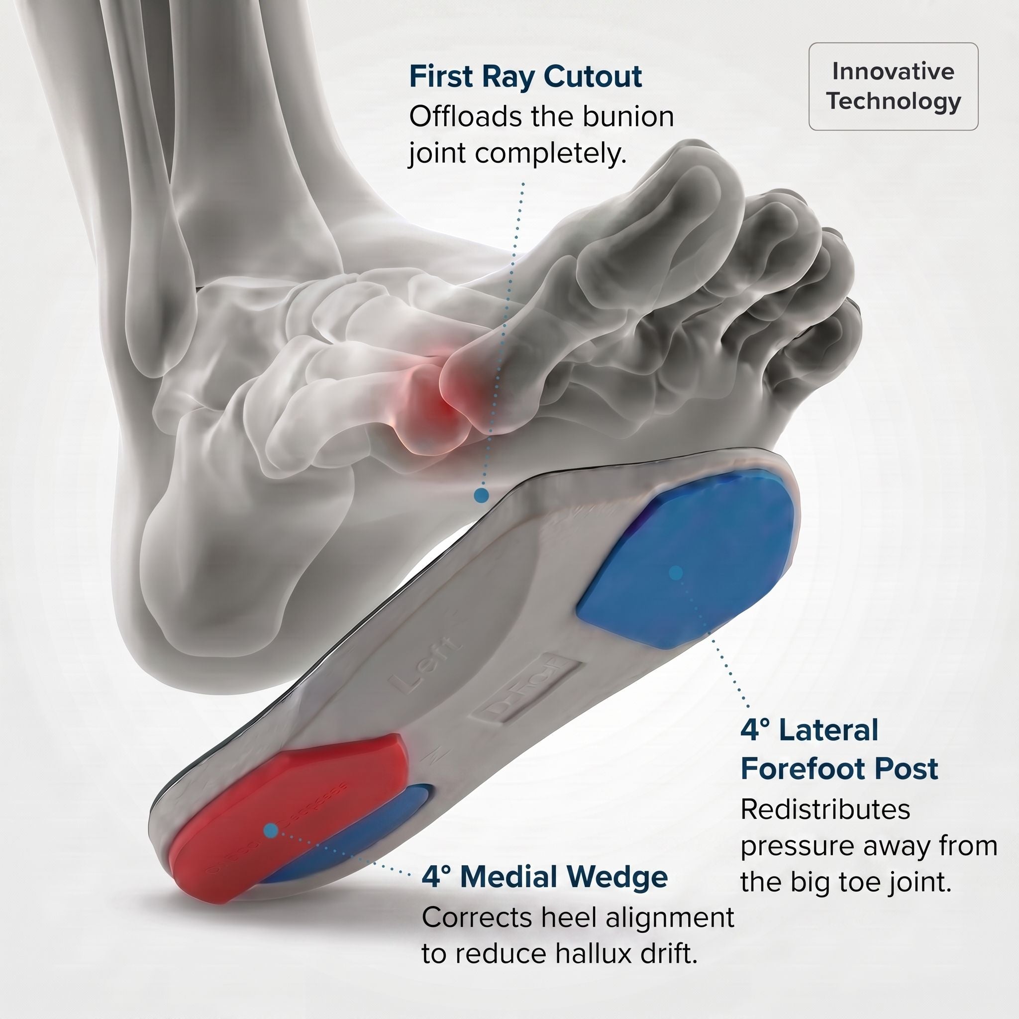 Dr Foot Bunion Insoles (Bespoke Series)