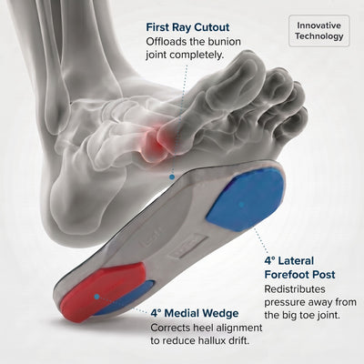 Dr Foot Bunion Insoles (Bespoke Series)