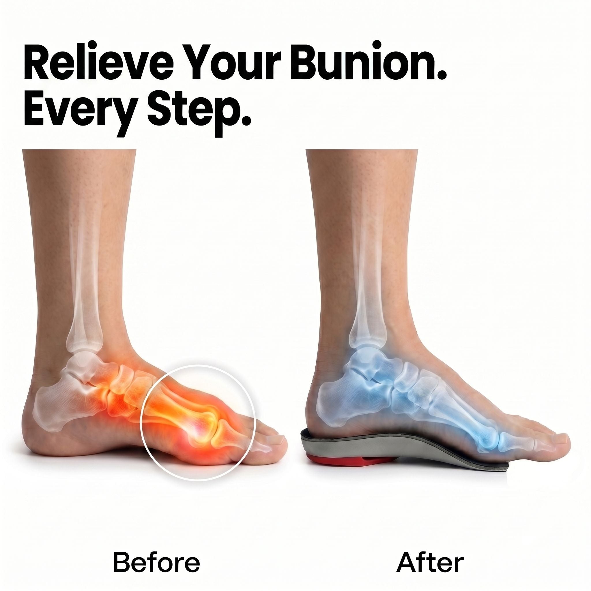 Dr Foot Bunion Insoles (Bespoke Series)