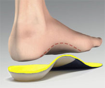 Dr Foot Custom Insole (CLEARANCE)